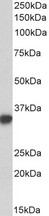 CD74 / CLIP Antibody - Antibody (0.03µg/ml) staining of Human Tonsil lysate (35µg protein in RIPA buffer). Primary incubation was 1 hour. Detected by chemiluminescence.