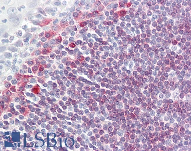 CD79A / CD79 Alpha Antibody - Anti-CD79A antibody IHC of human tonsil. Immunohistochemistry of formalin-fixed, paraffin-embedded tissue after heat-induced antigen retrieval. Antibody dilution 1:50.