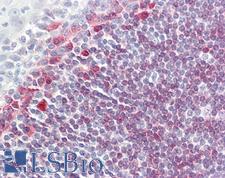 CD79A / CD79 Alpha Antibody - Anti-CD79A antibody IHC of human tonsil. Immunohistochemistry of formalin-fixed, paraffin-embedded tissue after heat-induced antigen retrieval. Antibody dilution 1:50.