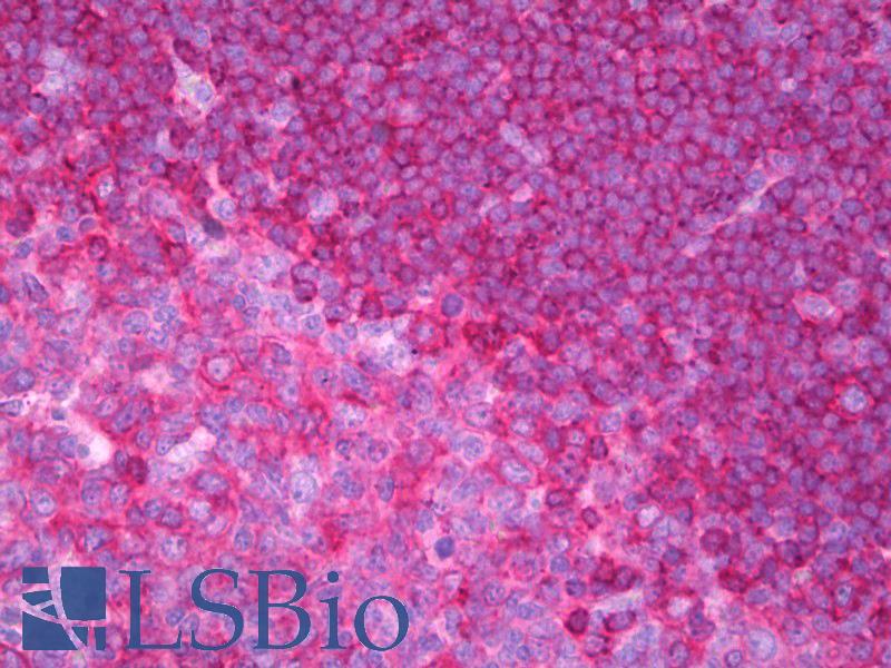 CD79B / CD79 Beta Antibody - Anti-CD79B antibody IHC of human tonsil. Immunohistochemistry of formalin-fixed, paraffin-embedded tissue after heat-induced antigen retrieval. Antibody concentration 2 ug/ml.  This image was taken for the unconjugated form of this product. Other forms have not been tested.
