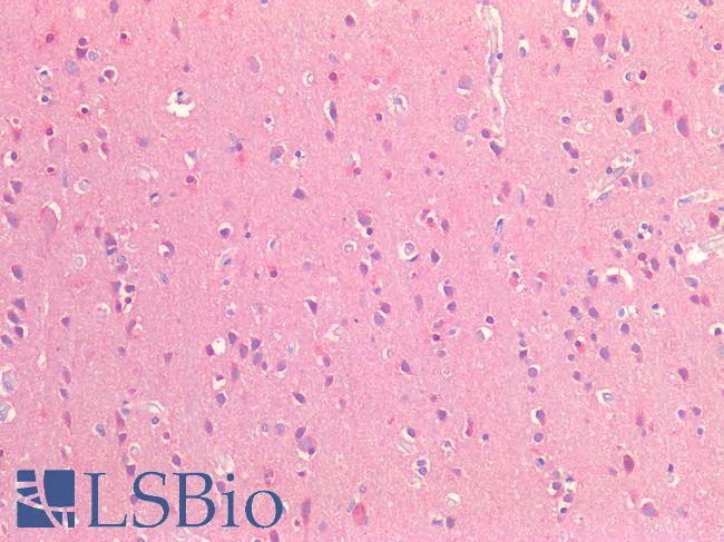 CD81 Antibody - Human Brain, Cortex: Formalin-Fixed, Paraffin-Embedded (FFPE)