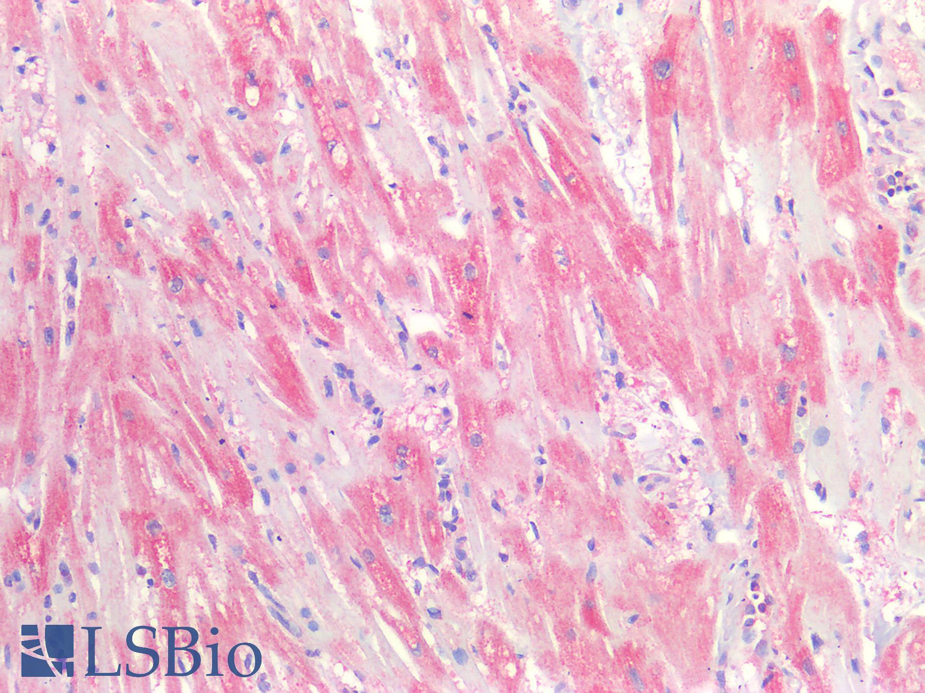 CD81 Antibody - Human Heart: Formalin-Fixed, Paraffin-Embedded (FFPE)
