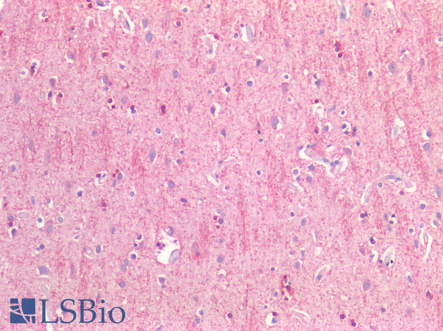 CD81 Antibody - Human Brain, Cortex: Formalin-Fixed, Paraffin-Embedded (FFPE)