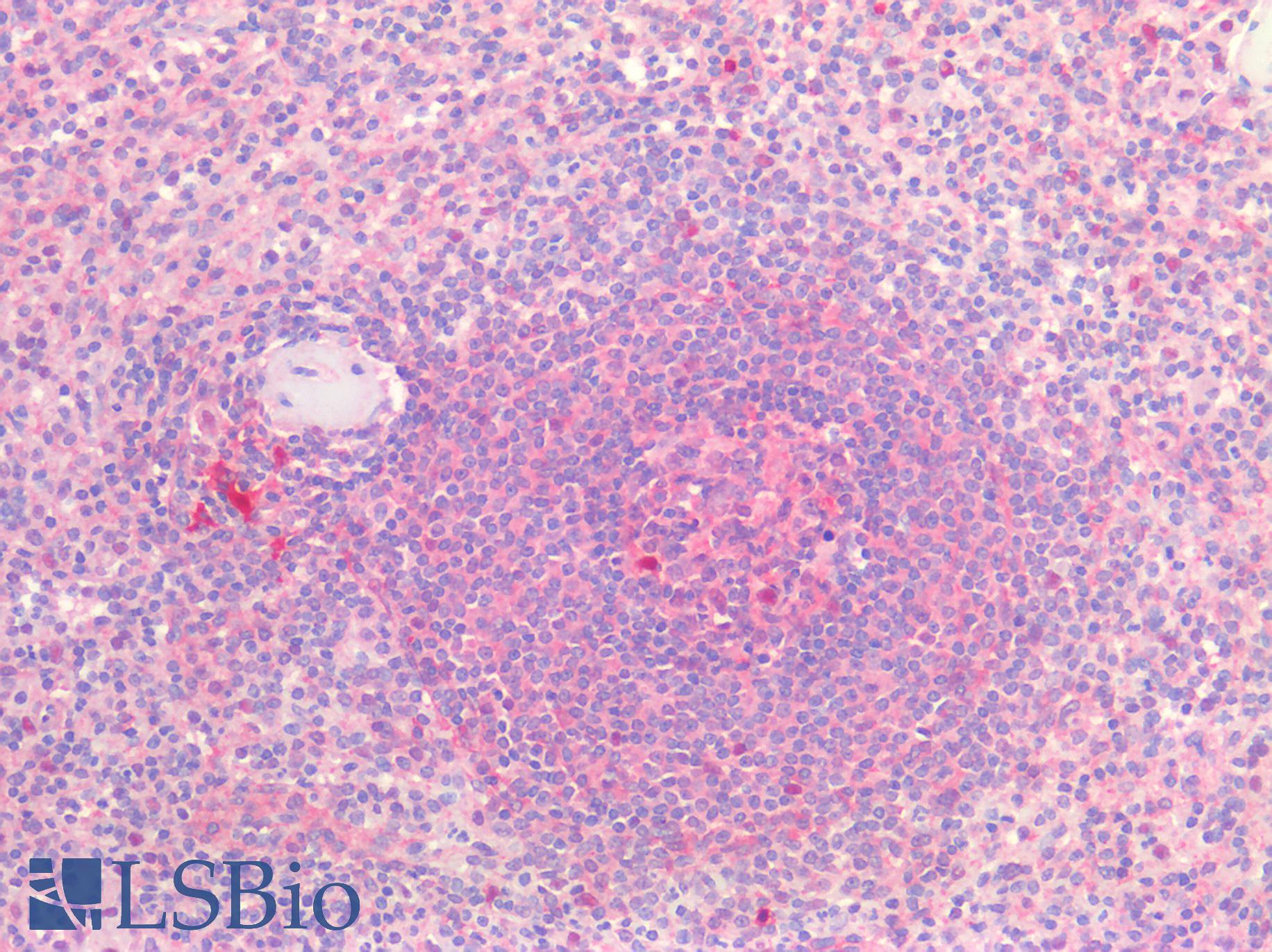 CD81 Antibody - Human Spleen: Formalin-Fixed, Paraffin-Embedded (FFPE)