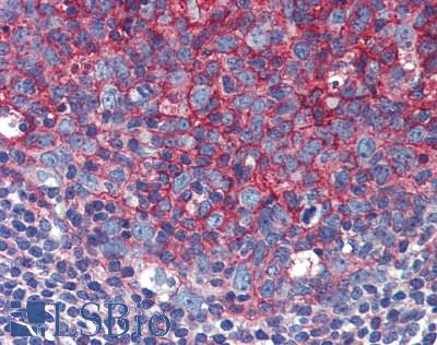 CD82 Antibody - Human Small Intestine, MALT: Formalin-Fixed, Paraffin-Embedded (FFPE)