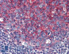 CD82 Antibody - Human Small Intestine, MALT: Formalin-Fixed, Paraffin-Embedded (FFPE)