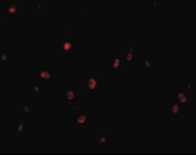 CD82 Antibody - Immunofluorescence of KAI1 in Human Colon cells with KAI1 antibody at 20 ug/ml.