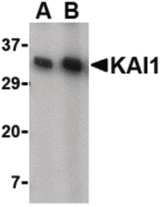 CD82 Antibody - Western blot of KAI1 in A549 cell lysate with KAI1 antibody at (A) 0.5 and (B) 1 ug/ml.