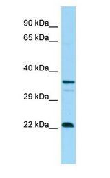 CD83 Antibody - CD83 antibody Western Blot of human fetal thymus lysate.  This image was taken for the unconjugated form of this product. Other forms have not been tested.