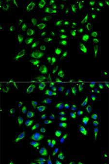 CD86 Antibody - Immunofluorescence analysis of MCF-7 cells using CD86 antibody. Blue: DAPI for nuclear staining.