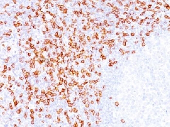 CD8A / CD8 Alpha Antibody - IHC testing of FFPE tonsil tissue with CD8 antibody (clone C8/144B).  This image was taken for the unmodified form of this product. Other forms have not been tested.