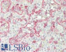 CD8A / CD8 Alpha Antibody - Human Spleen: Formalin-Fixed, Paraffin-Embedded (FFPE)