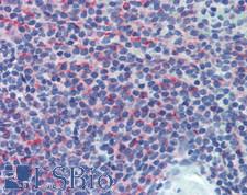 CD8B / CD8 Beta Antibody - Human Spleen: Formalin-Fixed, Paraffin-Embedded (FFPE)