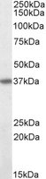 CD95 / FAS Antibody - FAS antibody (0.1 ug/ml) staining of MOLT4 lysate (35 ug protein in RIPA buffer). Primary incubation was 1 hour. Detected by chemiluminescence.