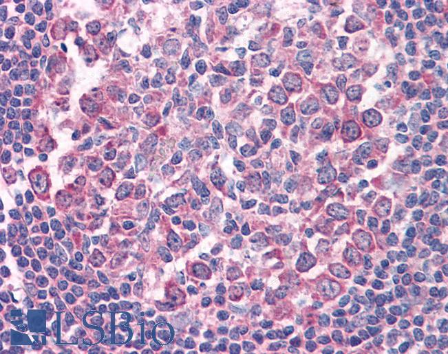 CD95 / FAS Antibody - Anti-FAS antibody IHC of human tonsil. Immunohistochemistry of formalin-fixed, paraffin-embedded tissue after heat-induced antigen retrieval. Antibody concentration 3.75 ug/ml.