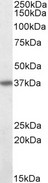 CD95 / FAS Antibody - CD95 / FAS antibody (0.1µg/ml) staining of MOLT4 lysate (35µg protein in RIPA buffer). Detected by chemiluminescence.