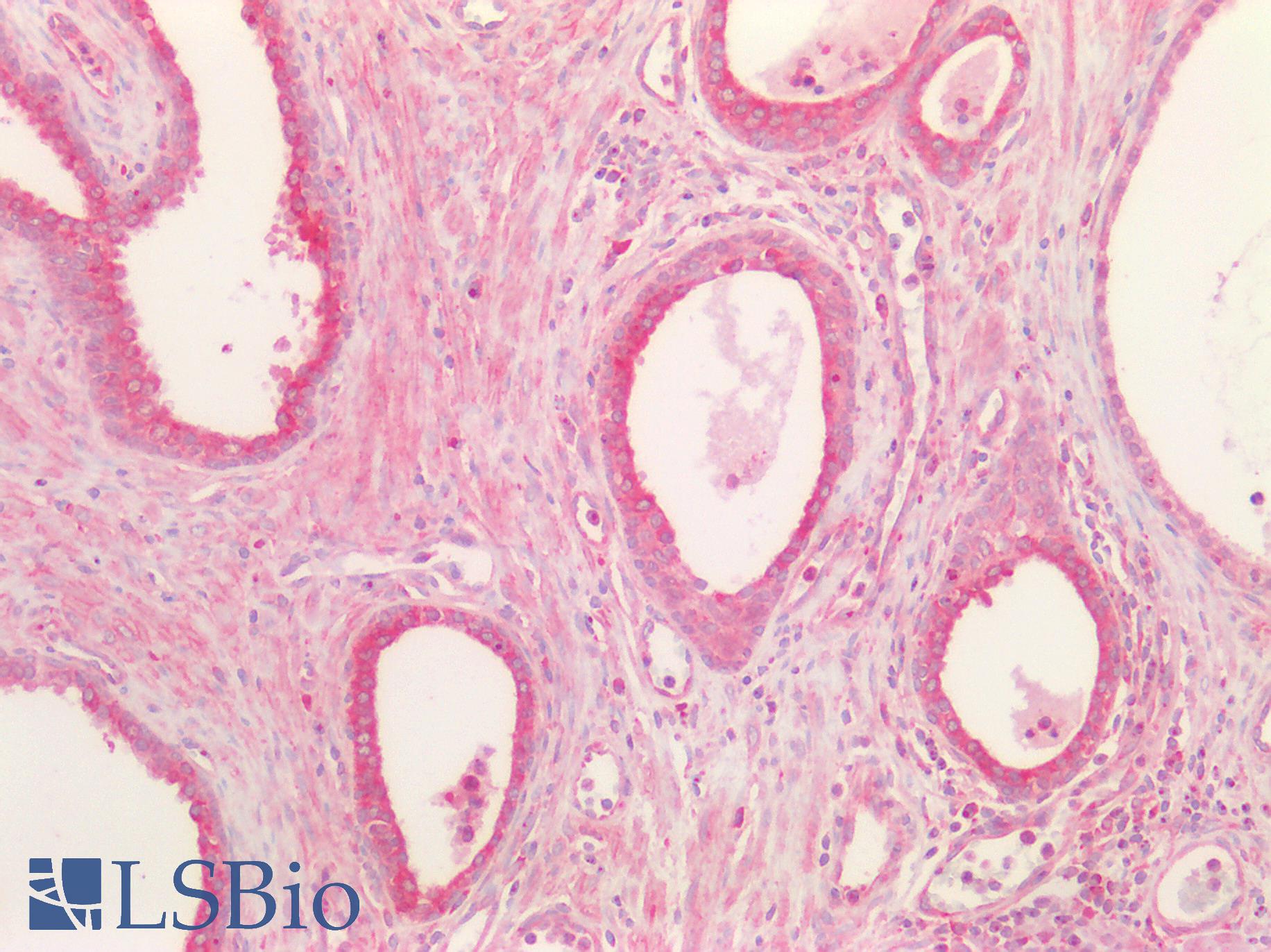 CD95 / FAS Antibody - Human Prostate: Formalin-Fixed, Paraffin-Embedded (FFPE)