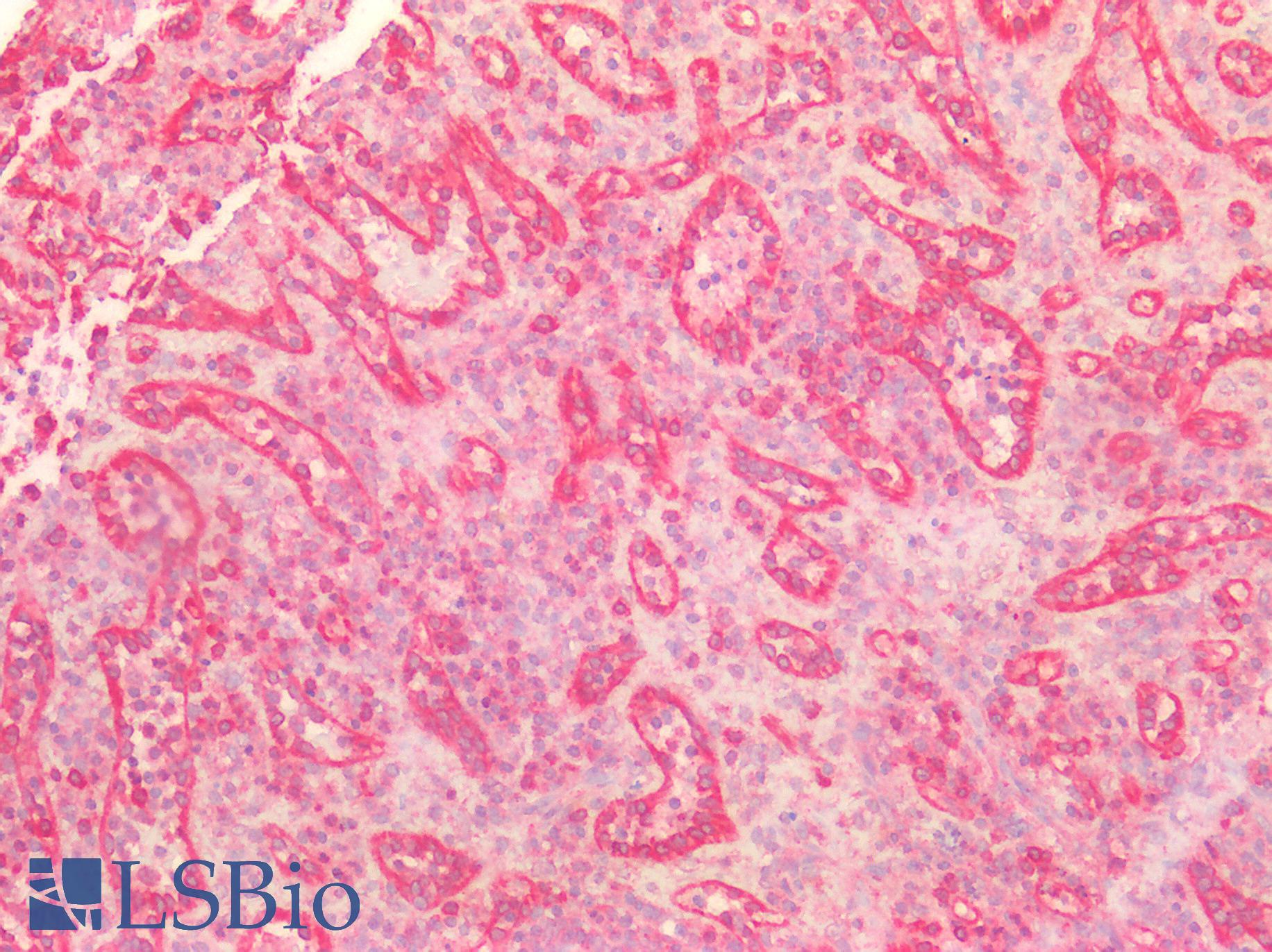 CD95 / FAS Antibody - Human Spleen: Formalin-Fixed, Paraffin-Embedded (FFPE)