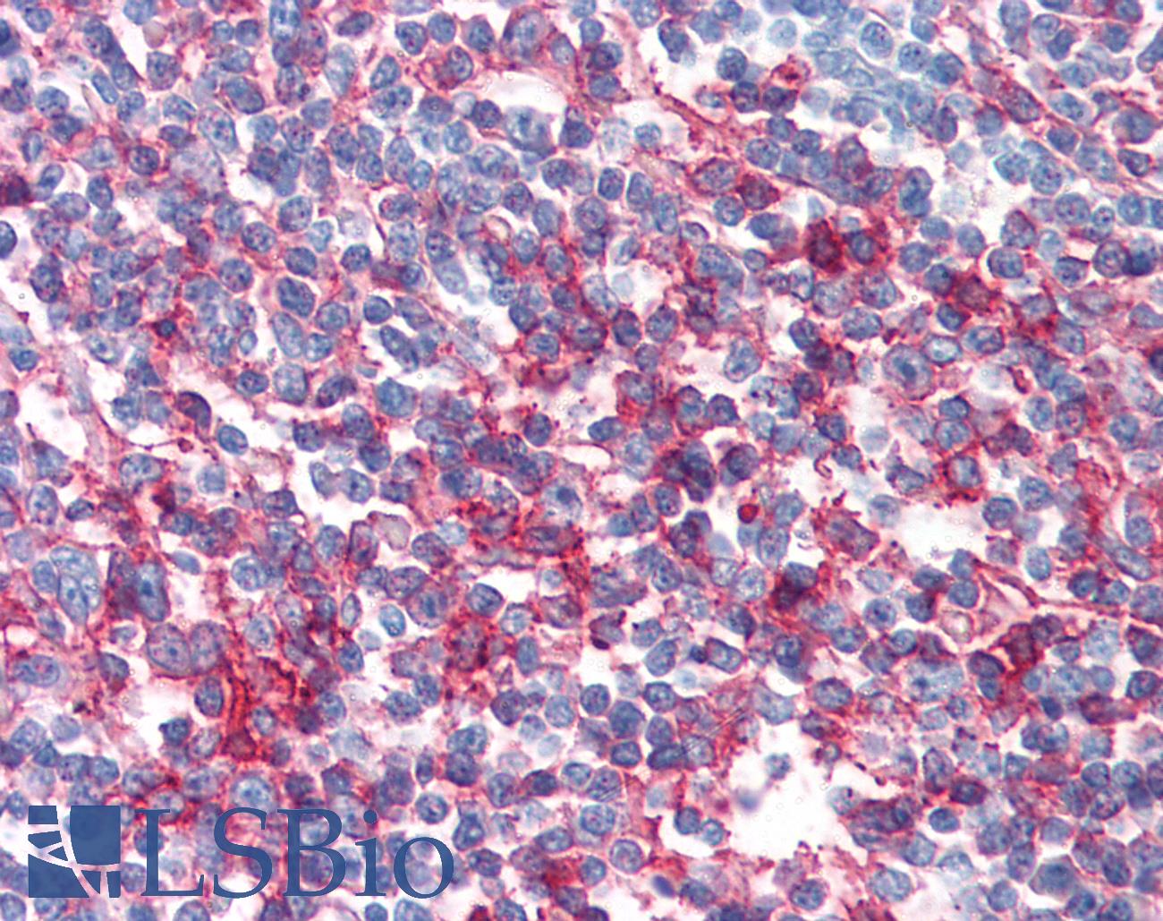 CD95 / FAS Antibody - Anti-FAS antibody IHC of human tonsil. Immunohistochemistry of formalin-fixed, paraffin-embedded tissue after heat-induced antigen retrieval. Antibody concentration 10 ug/ml.