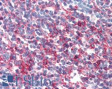 CD95 / FAS Antibody - Anti-FAS antibody IHC of human tonsil. Immunohistochemistry of formalin-fixed, paraffin-embedded tissue after heat-induced antigen retrieval. Antibody concentration 10 ug/ml.