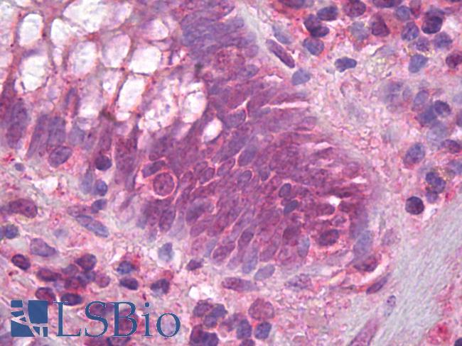 CD95 / FAS Antibody - Anti-FAS antibody IHC of human colon. Immunohistochemistry of formalin-fixed, paraffin-embedded tissue after heat-induced antigen retrieval. Antibody concentration 5 ug/ml.