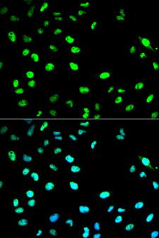 CDC20 Antibody - Immunofluorescence analysis of HeLa cell using CDC20 antibody. Blue: DAPI for nuclear staining.