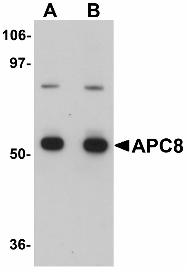 CDC23 Antibody - Western blot of APC8 in K562 cell lysate with APC8 antibody at (A) 1 and (B) 2 ug/ml.