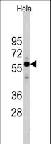 CDC25A Antibody - Western blot of Cdc25A antibody in HeLa cell line lysates (35 ug/lane). Cdc25A (arrow) was detected using the purified antibody.