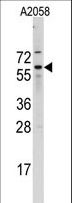 CDC25B Antibody - Western blot of Cdc25B Antibody (A166) in A2058 cell line lysates (35 ug/lane). Cdc25B (arrow) was detected using the purified antibody.