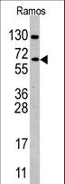 CDC25B Antibody - Western blot of anti-CDC25B Antibody (Cat #7256c) in Ramos cell line lysates (35 ug/lane). CDC25B(arrow) was detected using the purified antibody.