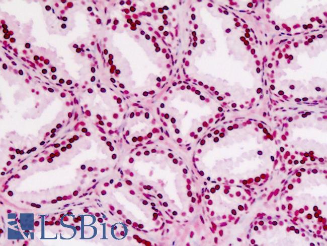 CDC25B Antibody - Human Prostate: Formalin-Fixed, Paraffin-Embedded (FFPE)