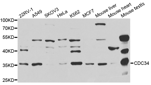 CDC34 Antibody - Western blot analysis of extracts of various cell lines, using CDC34 antibody.