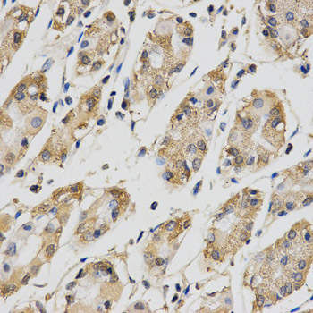 CDC34 Antibody - Immunohistochemistry of paraffin-embedded human stomach using CDC34 antibody at dilution of 1:200 (x400 lens).