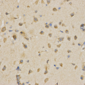 CDC34 Antibody - Immunohistochemistry of paraffin-embedded mouse brain using CDC34 antibody at dilution of 1:200 (x400 lens).
