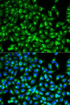 CDC34 Antibody - Immunofluorescence analysis of MCF-7 cell using CDC34 antibody. Blue: DAPI for nuclear staining.