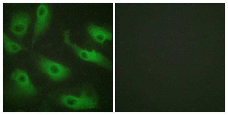 CDC37 Antibody - Immunofluorescence analysis of HeLa cells, using CDC37 Antibody. The picture on the right is blocked with the synthesized peptide.