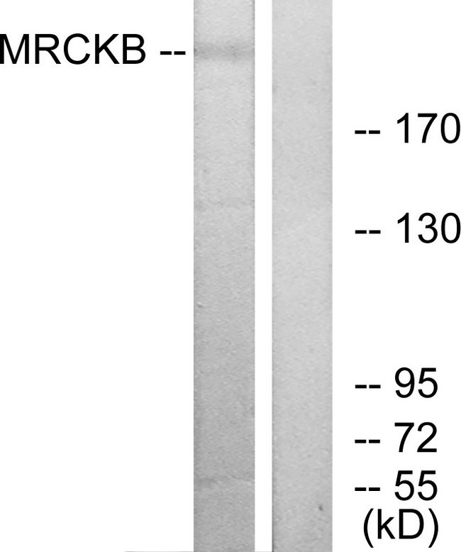 CDC42BPB / MRCKB Antibody - Western blot analysis of lysates from COLO cells, using MRCKB Antibody. The lane on the right is blocked with the synthesized peptide.