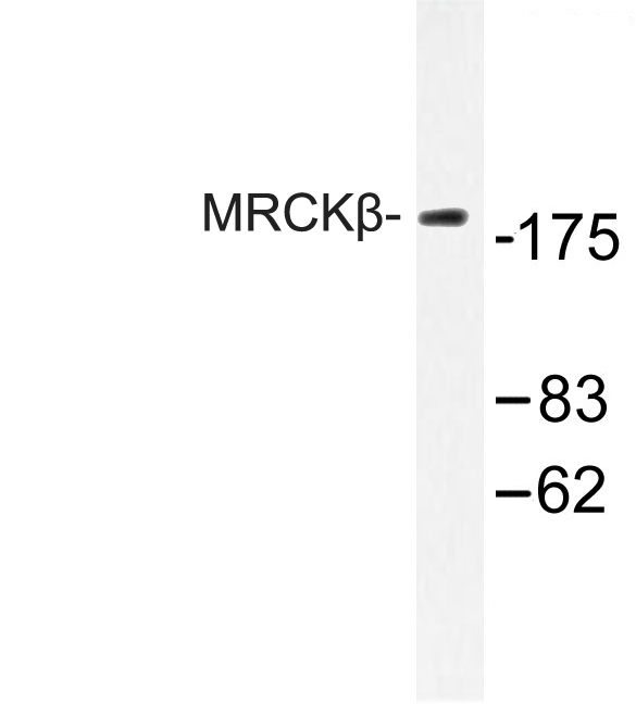 CDC42BPB / MRCKB Antibody - Western blot of MRCK (F1665) pAb in extracts from COLO cell.
