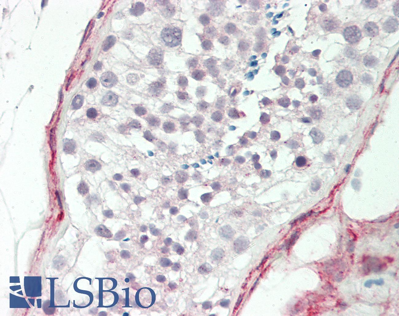 CDC42BPB / MRCKB Antibody - Human Testis: Formalin-Fixed, Paraffin-Embedded (FFPE)