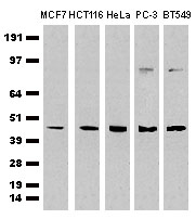 CDCP1 Antibody - Western Blot analysis of extracts (35&#181;g) from 5 different cell lines by using anti-CDCP1 monoclonal antibody (Clone 2B8).