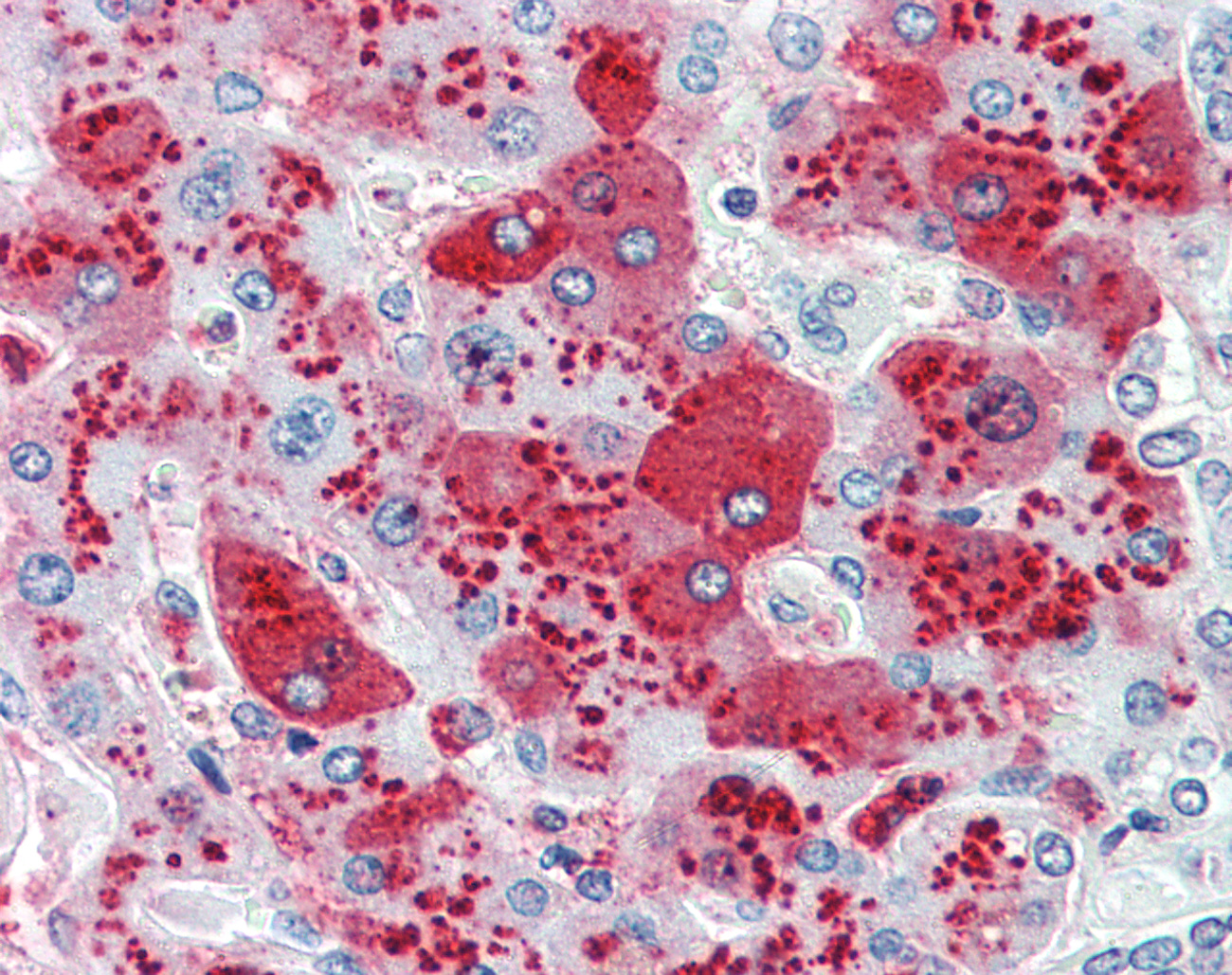 CDCP1 Antibody - Anti-CDCP1 antibody IHC of human liver. Immunohistochemistry of formalin-fixed, paraffin-embedded tissue after heat-induced antigen retrieval.