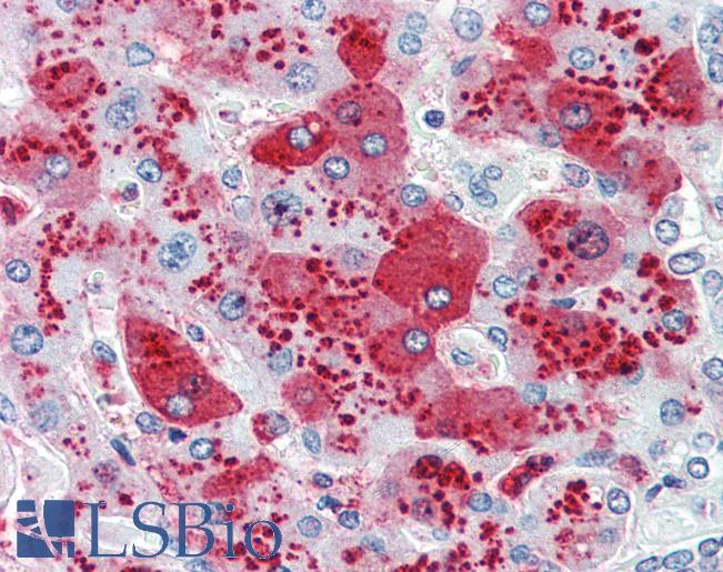 CDCP1 Antibody - Anti-CDCP1 antibody IHC of human liver. Immunohistochemistry of formalin-fixed, paraffin-embedded tissue after heat-induced antigen retrieval.