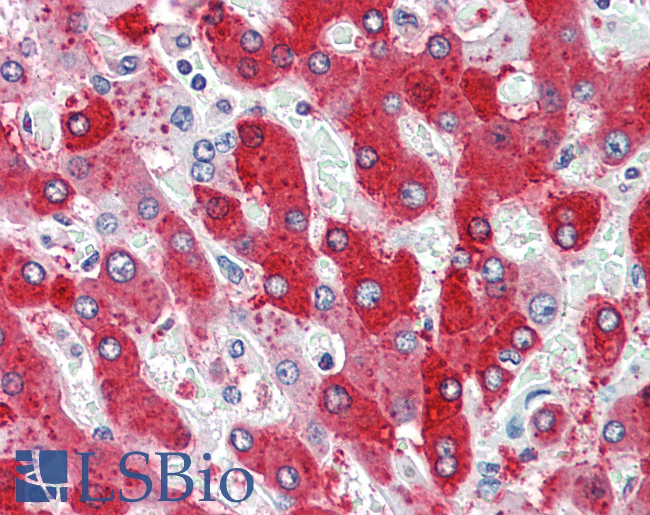 CDCP1 Antibody - Human, Liver: Formalin-Fixed Paraffin-Embedded (FFPE)