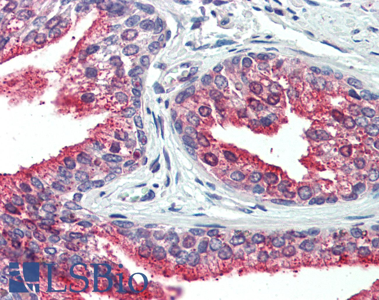 CDCP1 Antibody - Human, Prostate: Formalin-Fixed Paraffin-Embedded (FFPE)