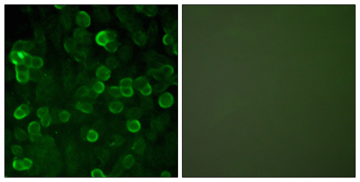 CDH1 / E Cadherin Antibody - Immunofluorescence analysis of A549 cells, using E-cadherin Antibody. The picture on the right is blocked with the synthesized peptide.