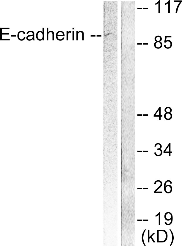 CDH1 / E Cadherin Antibody - Western blot analysis of lysates from 293 cells, using E-cadherin Antibody. The lane on the right is blocked with the synthesized peptide.