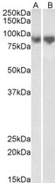 CDH1 / E Cadherin Antibody - Goat Anti-CDH1 (aa662-675) Antibody (0.3µg/ml) staining of Mouse Lung (A) and Rat Lung (B) lysates (35µg protein in RIPA buffer). Detected by chemiluminescencence.