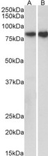 CDH1 / E Cadherin Antibody - Goat Anti-CDH1 (aa662-675) Antibody (0.3µg/ml) staining of Pig Kidney (A) and Colon (B) lysates (35µg protein in RIPA buffer). Detected by chemiluminescencence.