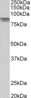 CDH1 / E Cadherin Antibody - CDH1 antibody (0.5 ug/ml) staining of Human Kidney lysate (35 ug protein in RIPA buffer). Primary incubation was 1 hour. Detected by chemiluminescence.