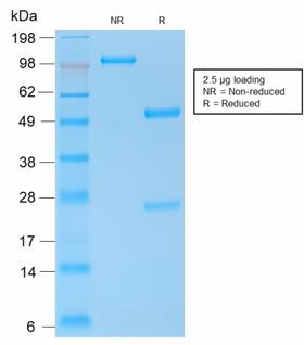 CDH1 / E Cadherin Antibody - SDS-PAGE Analysis of Purified E-Cadherin Rabbit Recombinant Monoclonal Antibody (CDH1/2208R). Confirmation of Purity and Integrity of Antibody.